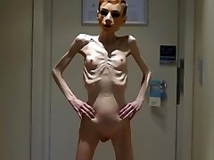 Anorexia Christin showing her Shafts & Bony Skeleton