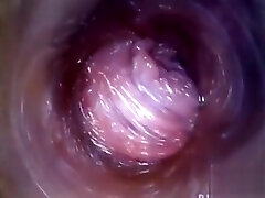 Flirty Czech Girl Spreads Her Narrowed Vagina To The Peculi