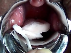 MiracleSatchin Asian TAMPON injection my Cervix 