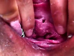 Amateur medical school sex close up fucking creampie