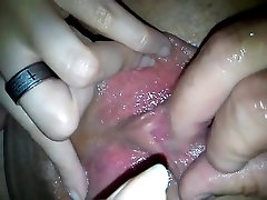 Razradjivanje picke prsticima nakon mesec docter control bez seksa