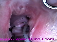 Extreme tgirl fuck girl vica milla Fisting, Huge Objects, Cervix Insertion, Peehole Fucking, Nettles, Electro Orgasms and Saline Injection
