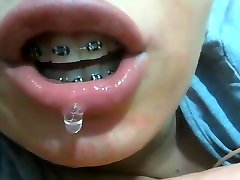 Mouth fetish braces part2