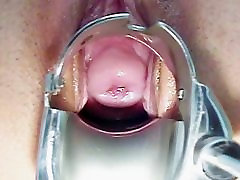 Sara big ass hard cone pussy speculum exam by kinky old doctor