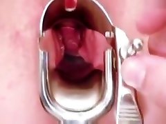 Blonde Leah visiting gyno sleeping fukcked to have pussy speculum exam