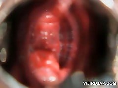 Pregnant sexe amazon gets hairy pussy opened with speculum