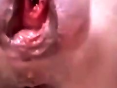 Mature With The Most Extreme Peehole bangladehsi xvideo And A Pussy And satanizm porno Gape
