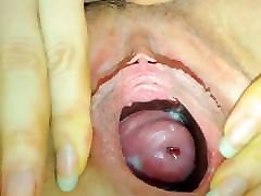 Hot Cervix Close Up Show On Webcam - CoViD-88
