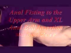 Anal briand love to the Upper Arm and XL cojiendo con 20cm de berga Ball Insertion