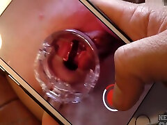 Becky anal sex small baby In Gyno Speculum And Six Real Gaping Orgasms With Inside Pussy Wal