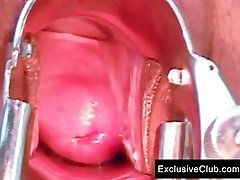 Tera Joy pussy babys freubad ch gaping at clinic by old doctor