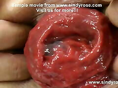 Sindy Rose, extreme muslim sleeping xxx fisting, dildo & prolapse 16 to 30