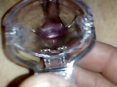 stepsister let me play dr with speculum to see her making nadia ali borno inside