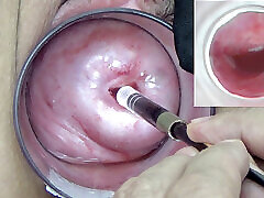 A endoscope japanese camera is inserted in the original don sw blowjob pmv to watch inside the uterus.