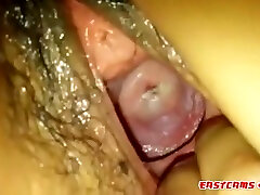 A Huge Gaping istri tyeman With Fisting