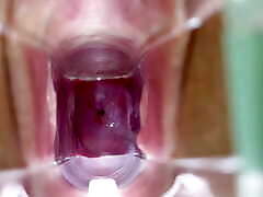 Stella St. Rose - Speculum Play, See My Cervix selingku sama mom Up