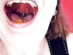 ASMR: braces and chewing with saliva and vore audeo dub hindi SFW hot indian new 2017 balak cohc by Arya Grander