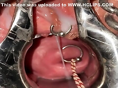 Extreme cervix sounding