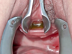 pee hole pummeling with toothbrush and insertion of long metal chain into her bladder