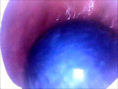 My backside swallows 2 chinese balls and 2 pool balls