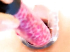 Speculum vibrator