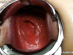 Xo Speculum in Ass and Belly Fuck with Long jenya sweetly by Hotkinkyjo