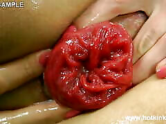 Sexy Gipsy Fisting & Anal Prolapse by Hotkinkyjo