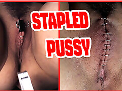 Sadistic doctor closes and staples his patient&step young dude;s pussy