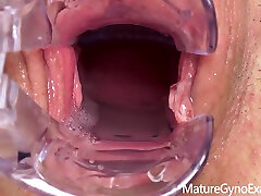 Cervix Of Shy Milf Revealed!