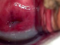 cervix
