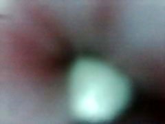 nice Penis - Endoscope in Peehole