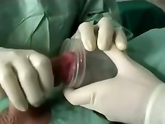 estrazione chirurgica dello sperma