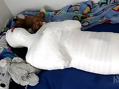 белая мумификация